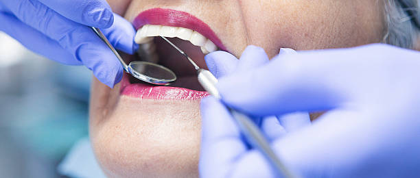 Best Broken or Cracked Tooth Emergency Dentist in South Duxbury, MA